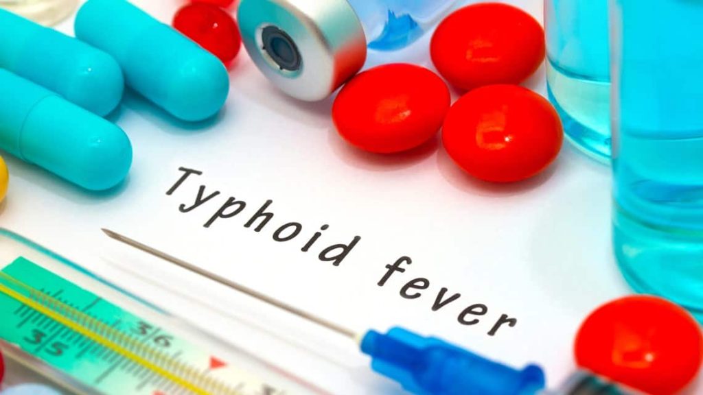 Typhoid Fever: A Guide to Prevention, Diagnosis, and Treatment