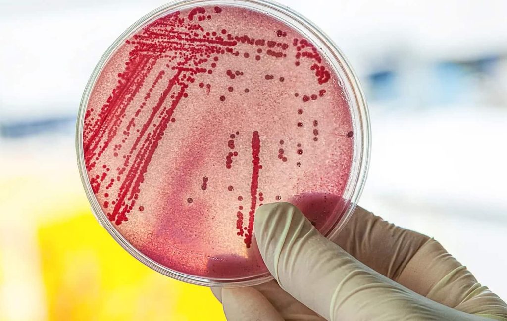 Understanding EHEC (Enterohemorrhagic Escherichia coli) Infections