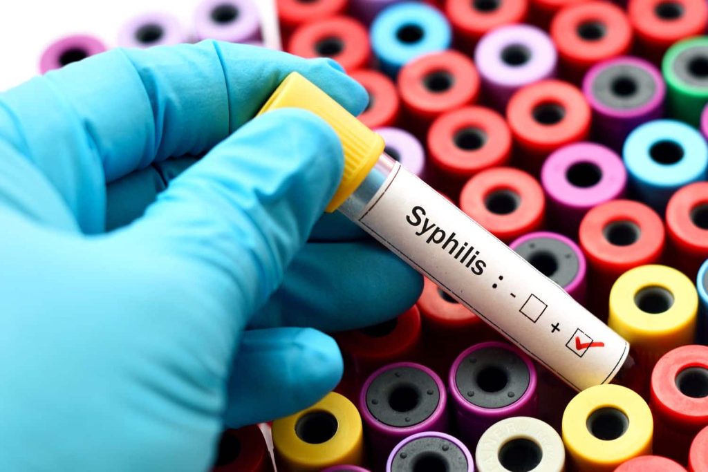 Understanding Syphilis A Comprehensive Guide