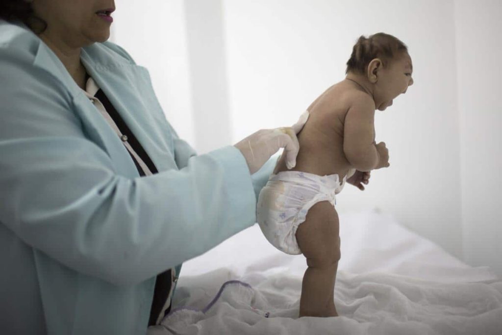 Understanding the Zika Virus